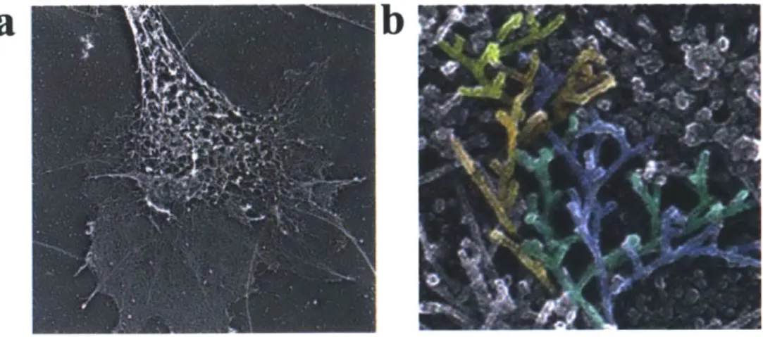 Figure  11.  (a)  Electron  microscopy  showing actin  cytoskeleton  (NIH)  (b)  highlighting