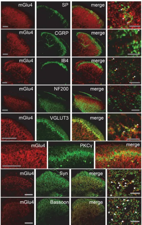 Figure 2. Localization of mGlu4 receptors in inner lamina II of the dorsal horn of mice spinal cord