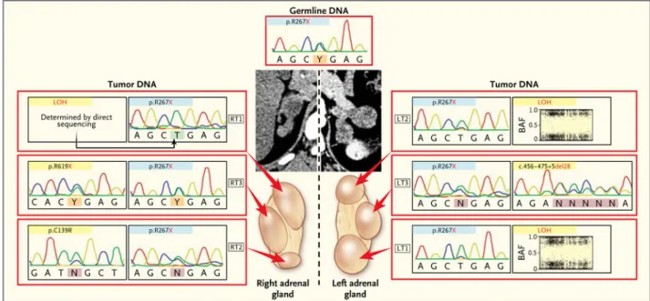 Figure 3. Analysis of Multiple Nodules Obtained from the Same Patient