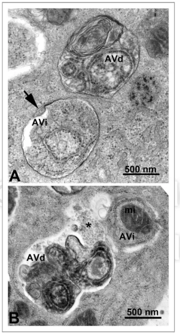 Figure 2. TEM images of autophagic vacuoles in isolated mouse hepatocytes. (A) One autophagosome or early autophagic vacuole (AVi) and one degradative autophagic vacuole (AVd) are shown