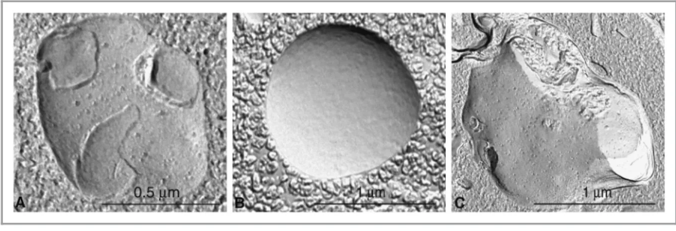 Figure 3. Different autophagic vesicles observed after freeze fracturing in cultured osteosarcoma cells after treatment with the autophagy inducer voacamine