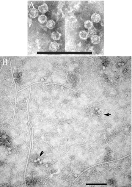 Fig 4. (A) Transmission electron microscopy of partially purified alfalfa virus F and (B) transient expression of AVF virus-like particles in Nicotiana benthamiana plants using a PVX-based vector