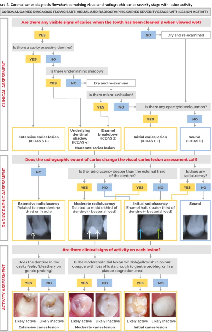Figure 3. Coronal caries diagnosis flowchart combining visual and radiographic caries severity stage with lesion activity