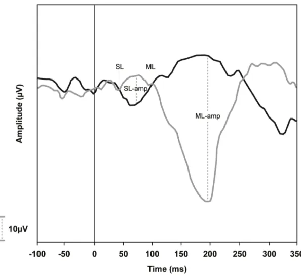 Fig 2. A normal vestibular-evoked myogenic potential triggered by galvanic vestibular stimulation (galvanic-VEMP) tracing