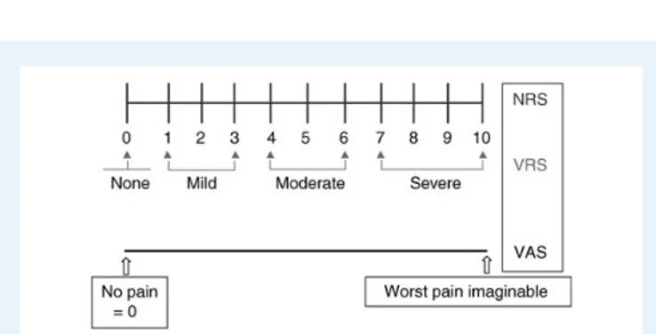 Figure 2 VAS, NRS (numeric rating scale) and VRS (verbal rating scale). From Breiviket al