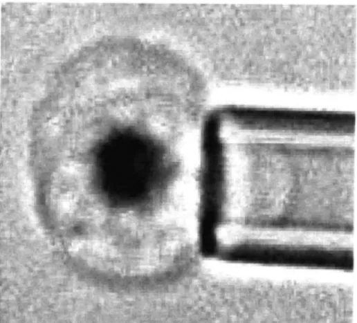 Figure 9:  picture of  micropipette aspiration of a malaria infected  red blood  cell