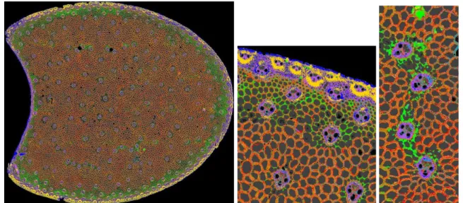 Figure 1. Example of multispectral fluorescence image segmentation. Left whole image (initial  size 6397 x 5387 pixels  17 x 14 mm²