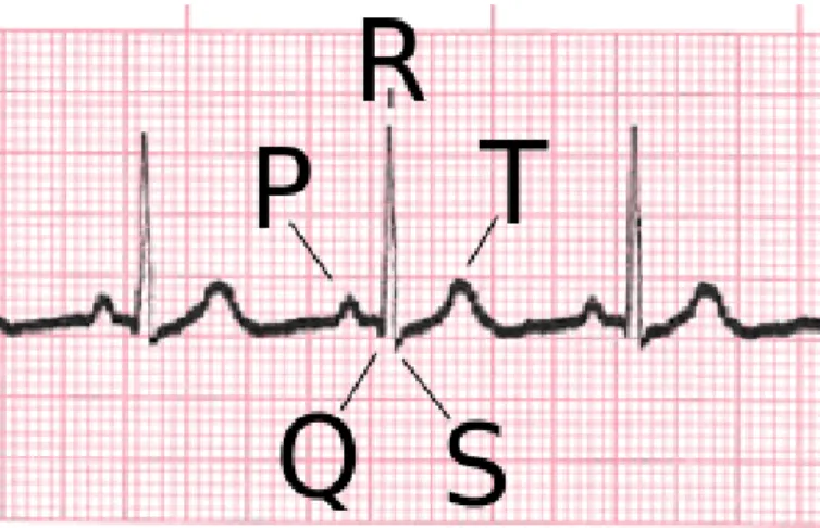 Figure 2-2: A normal ECG with labels on characteristic features. Figure adapted from [1].