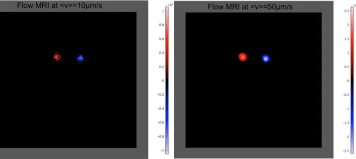 Fig 7. Flip-flop flow-MRI. Right figure: at 10μm/s and left figure: 50μm/s. The following parameters were used: T R = 1.2s, T E = 15ms, FOV READ = 40mm, FOV PHASE = 40mm, N READ = N PHASE = 256, T hk = 0.5mm, 2 slices, AVG = 2 and T acq = 2 × 10min14.