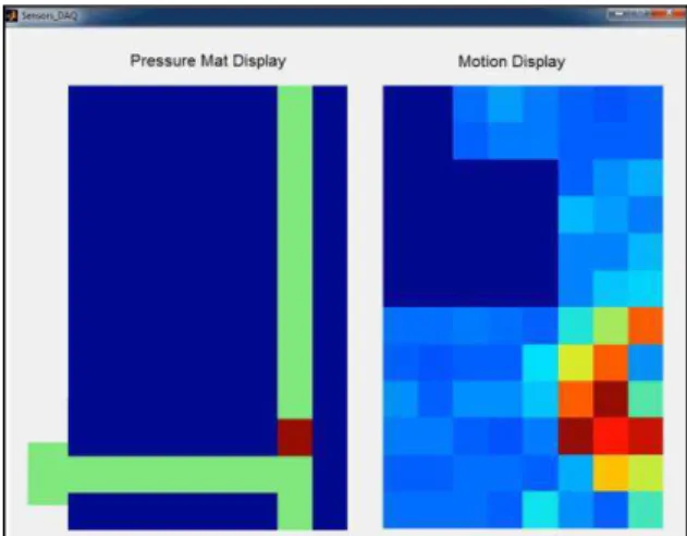 Figure 4. Screen capture from the data acquisition software. Note: Each colour  on the “Motion Display” 