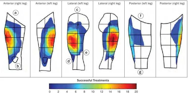 Figure  3A . Sensory area distribution maps observed for successful nerve blocks. Overlapping areas shared between patients are  denoted by the area color.