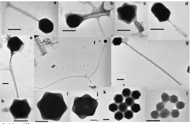 Figure 2 Transmission electron micrographs of typical freshwater viruses observed along the 40 cm sediment core from Lake Pavin.
