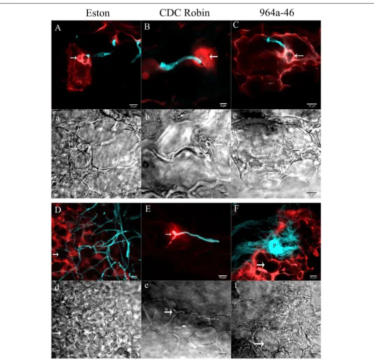 FIGURE 3 | Cellular reactions of partially resistant lentil genotypes to A. lentis infection captured by two photon CLSM at 60 (A,a,B,b,C,c) and 90 hpi (D,d,E,e,F,f)
