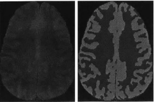 Figure  1-1:  These images,  taken from http://www.fmrib.ox.ac.uk/analysis/research/fast/, show  one  slice  of  a  brain  MRI,  and  the  segmentation  of  that  slice  into  white  and gray  matter.