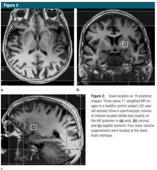 Figure 2:  Voxel location on  1 H anatomic  images. Three-plane T1-weighted MR  im-ages in a healthy control subject  (42-year-old woman) show a spectroscopic volume  of interest located (white box) exactly on  the left putamen in (a) axial, (b) coronal,  