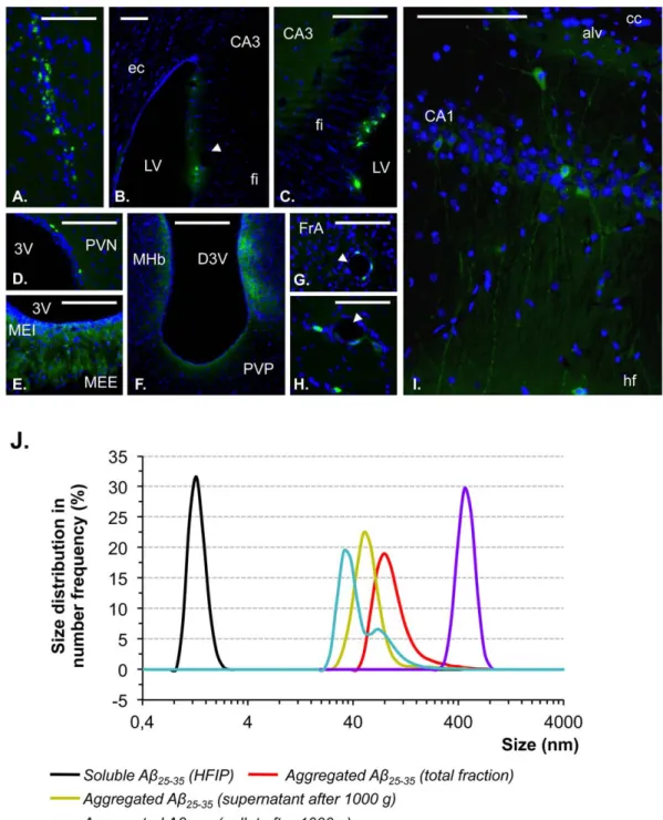 Figure 1. Brain localization of Ab 25–35 and particle characterization of Ab 25–35 solutions A–I