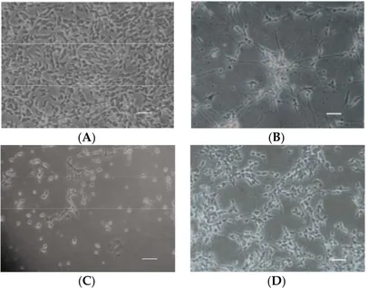 Figure 4. Cell morphology of undifferentiated SH-SY5Y cells (A); differentiated SH-SY5Y cells (B);