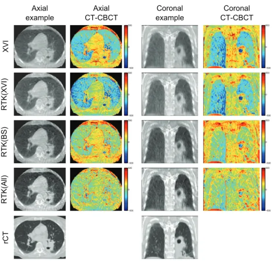 Figure B2.   Example images for patient 2. The example axial and coronal images are  shown with a display range of ( −250 1400  ) , to show contrast in the lung tissue as well  as soft tissue