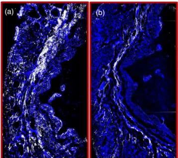 Fig. 15 Structural motifs in second-harmonic collagen images of arterial tissue biopsies that have distinct texture properties based on gray level cooccurrence scores calculated for the images, labelled (a) to (i).