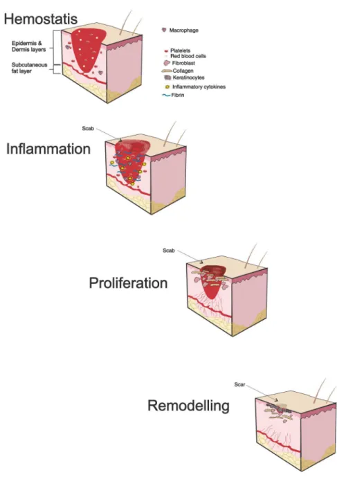 Fig. 1 Illustration of the phases of wound healing. Healing of soft tissue is often portrayed in four phases that overlap