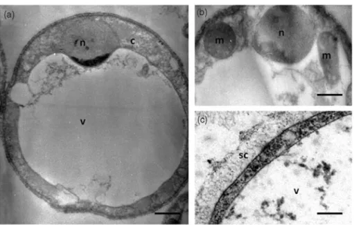 Figure 1. Vacuolar form of in vitro cultivated Blastocystis sp. viewed under transmission electron microscopy (a)