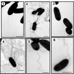 Figure 1. Transmission electron microscopy of A. hydrophila strains. AH-1 wild type grown in liquid media (TSB) (1) or in solid media (TSA) (2); AH-1 ∆ pseI mutant grown in TSB (3) or in TSA (4); AH-1 ∆ pseI mutant + pBAD-pseI grown in TSB (5), and AH-1 ∆ 