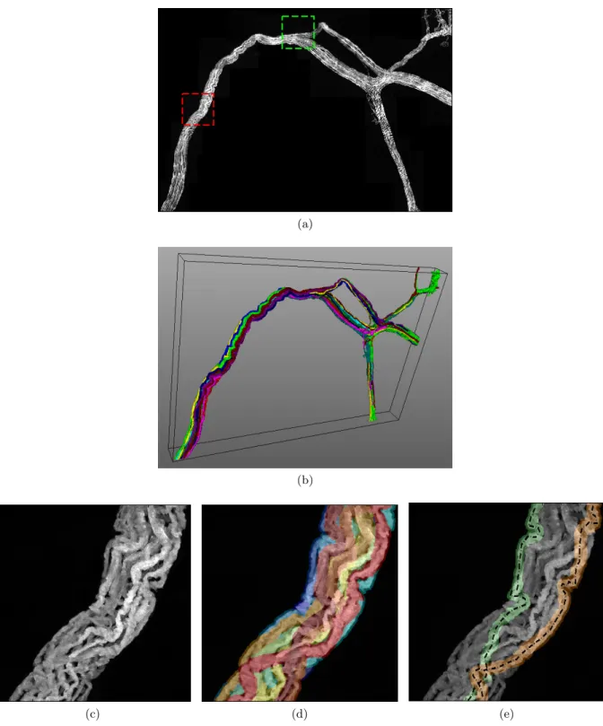 Figure 2: Results of the segmentation of the 31 first blocks of the dataset. (a) MIP image of the input blocks.