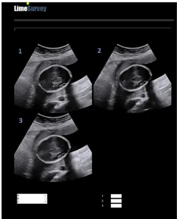 Figure 2 Screenshot of online questionnaire image. Raters were asked to rank from A (most acceptable) to C (least acceptable) quality of each of three images (1,2,3) in same ultrasound plane acquired at three different ultrasound propagation velocity setti