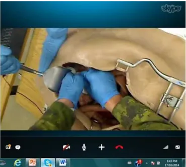 Figure 1. Remote mentor’s screen illustrating the surgical simulator as viewed through the MedTechs head-mounted camera.