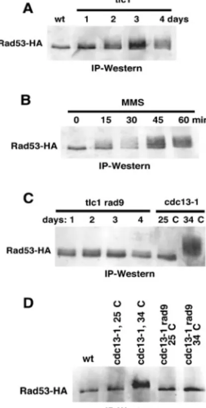 Figure 1 Activation of Rad53 visualized by IP-Western blotting