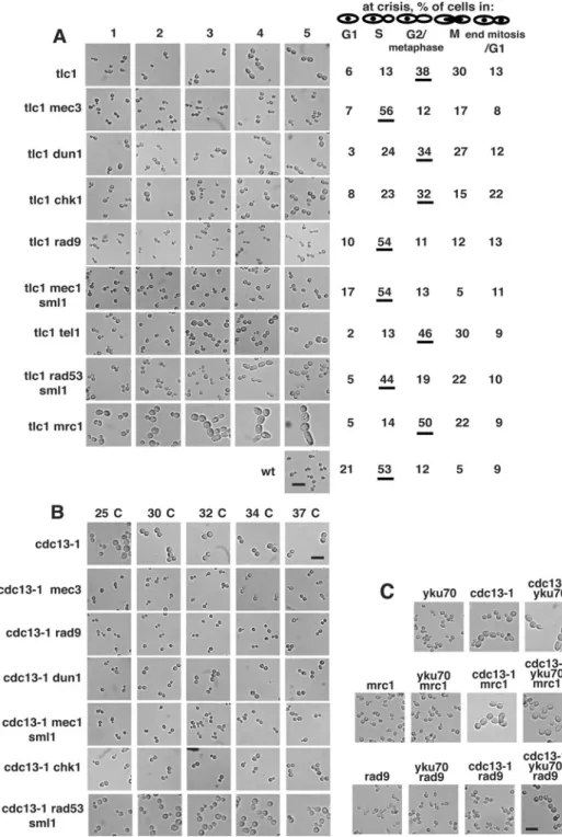 Figure 6 Representative morphologies of telomerase-negative cells tlc1  (A) and cdc13-1 cells (B) in various checkpoint mutation backgrounds, as indicated, at 30 ◦ C (A) or at the indicated temperature (B)