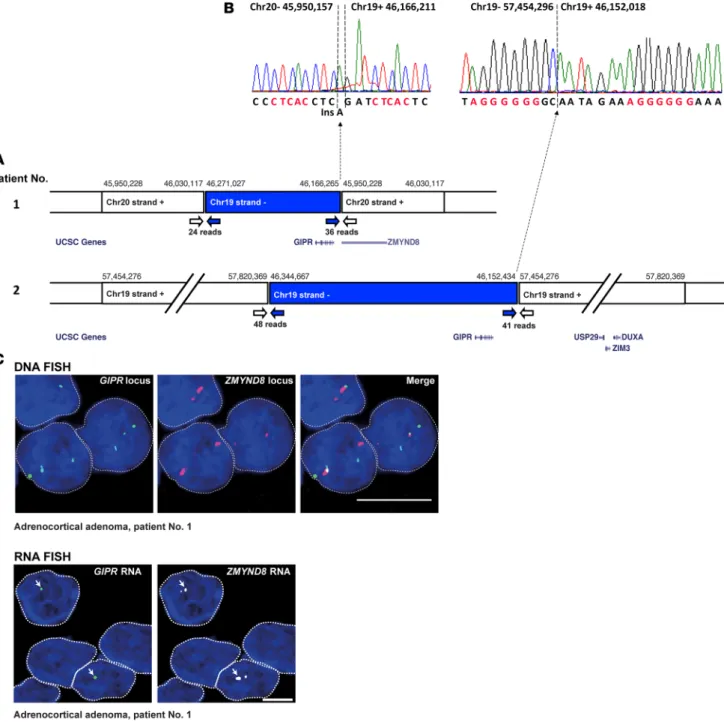 Figure 3. Chromosome rearrangements in adrenocortical adenoma of two patients with glucose-dependent insulinotropic polypeptide–dependent  (GIP-dependent) Cushing’s syndrome drive ectopic GIP receptor (GIPR) expression in adenoma cells