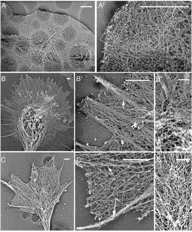 Figure 2. Comparison of Actin Filament Organization in Fibroblasts and Neuronal Growth Cones