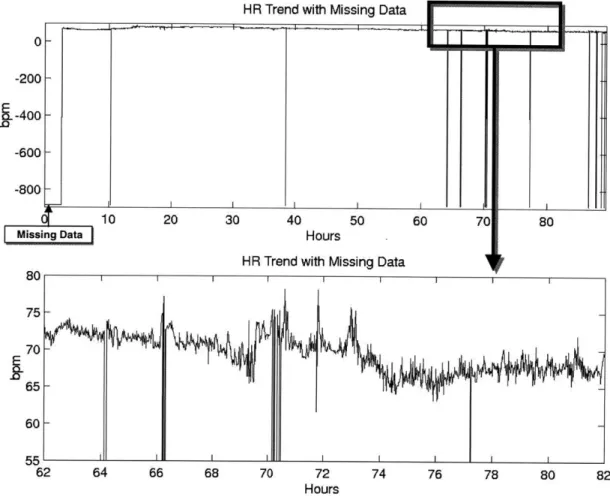 Figure 3.2 shows  a heart rate trend recording containing  missing  data.  Notice  the large section  of missing  data in the beginning compared to the smaller segments  throughout the remainder of the recording