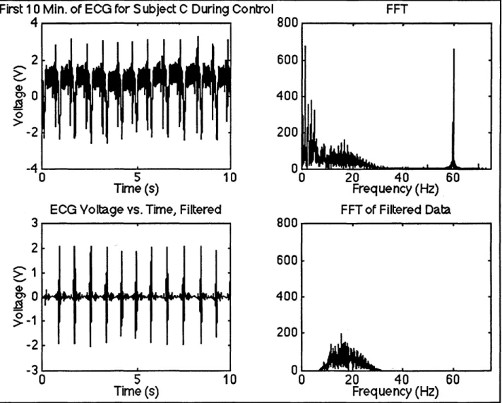 Figure  10.  Example  of  Filtering  of  ECG  Signals