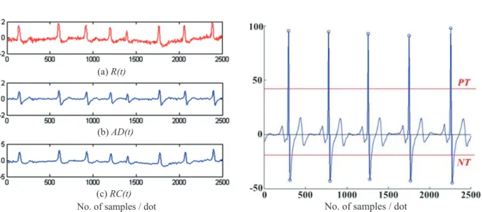 Fig. 1. Data preparation: (a). the raw AECG signal R(t); (b).