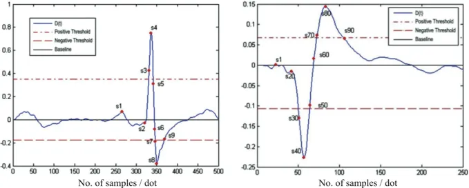Fig. 3. Data structure of QRS complex: QRS_COMPLEX.
