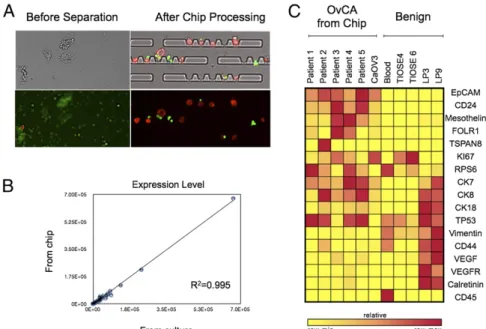 Fig. 6. On-chip Processing. (A) Processing ascites samples on-chip enables puri ﬁ cation of ATCs (red) from benign cells (green) for easy detection of ATCs