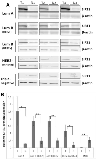 Figure 3: Differential SIRT1 protein expression patterns in breast tumors.  ( A ) Representative immunoblots of 3 independent  experiments showing SIRT1 protein expression in the 5 molecular subtypes of breast cancer