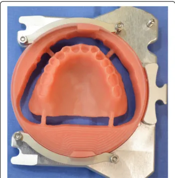 Fig. 31 A positioning key is milled to ensure the ideal setting of the teeth during the bonding process with a PMMA resin