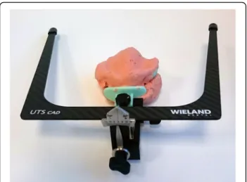 Fig. 4 UTS CAD® device connected to the Centric Tray® for recording deviations from the reference planes