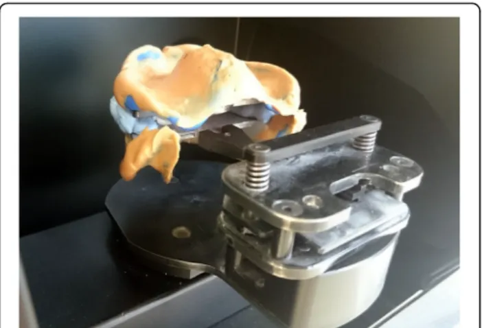 Fig. 21 Numerical models are placed on the virtual articulator and identified reference points