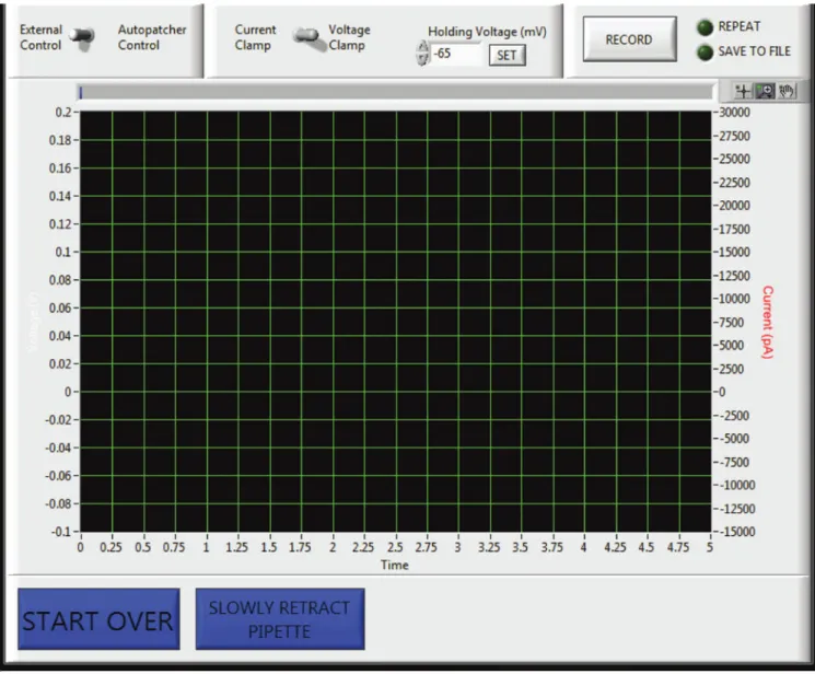 FIGURE 8. Autopatcher software graphical user interface: recording