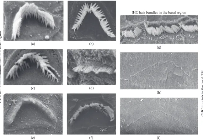 Figure 7: Abnormal hair bundle shapes observed in the basal cochlear region. SEM pictures of organ of Corti sections ((a)–(g)) and of tectorial membrane (TM) ((h), (i)) from CD1 mice