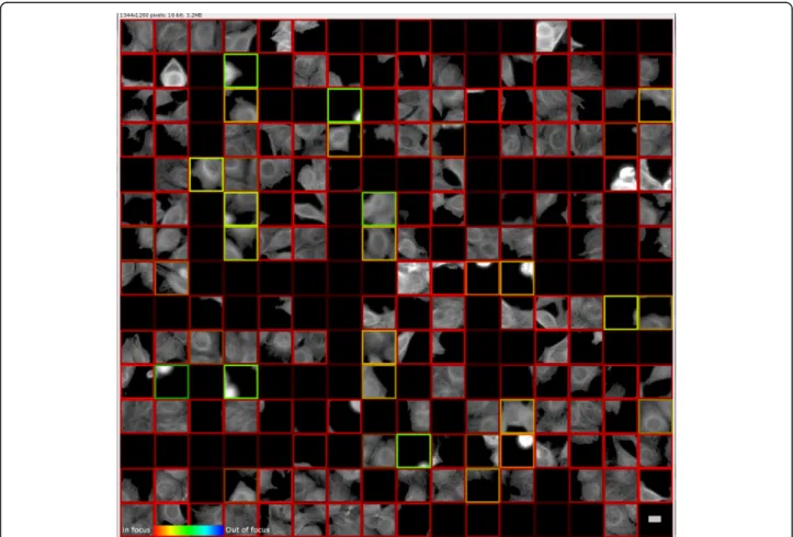 Fig. 7 Prediction of absolute focus quality on an unseen cell type (MCF-7 cells, from BBBC021 dataset [12]) and unseen stain, Tubulin, using our Fiji (ImageJ) [20] plugin with pre-trained TensorFlow model