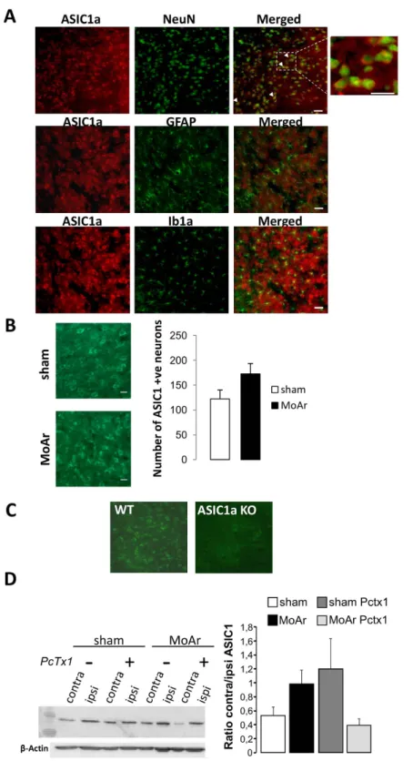 Figure 4.  Expression of the ASIC1a protein in the basolateral amygdala (BLA) of MoAr rats