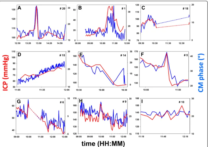 Fig. 2 Examples of individual time courses of ICP ( red , mmHg) and CM phase ( blue , degrees)