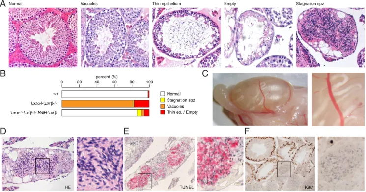 Figure 6. Rescue of Lxr ␤ expression in Sertoli cells suppresses seminiferous epithelium degeneration and reveals abnormal spermatozoa transit