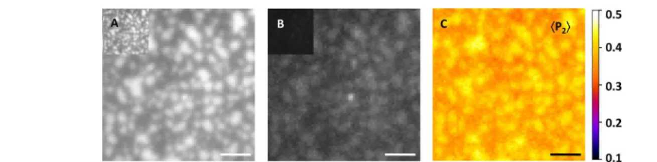 Figure 5. Time-dependent morphological changes in a DOPC/ESM/Chol supported bilayer (2:2:1 molar ratio with 0.5 mol % NBD-Cer) and treated with SMase (0.2 U/mL) in bu ﬀ er (pH 7.4)