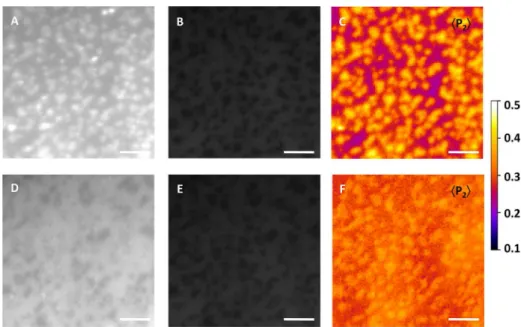 Figure 6. Changes in membrane order resulting from the SMase-mediated reorganization of DOPC/ESM/Chol bilayers (2:2:1 molar ratio) stained with 0.5 mol % NBD-Cer were quanti ﬁ ed using pTIRFM